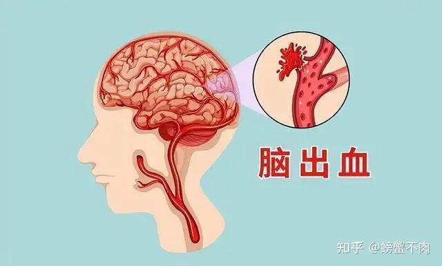 高血压的危害你注意了吗？